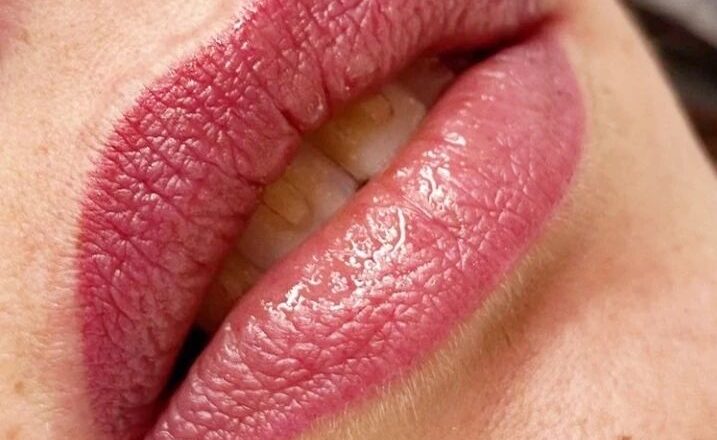LABIOS